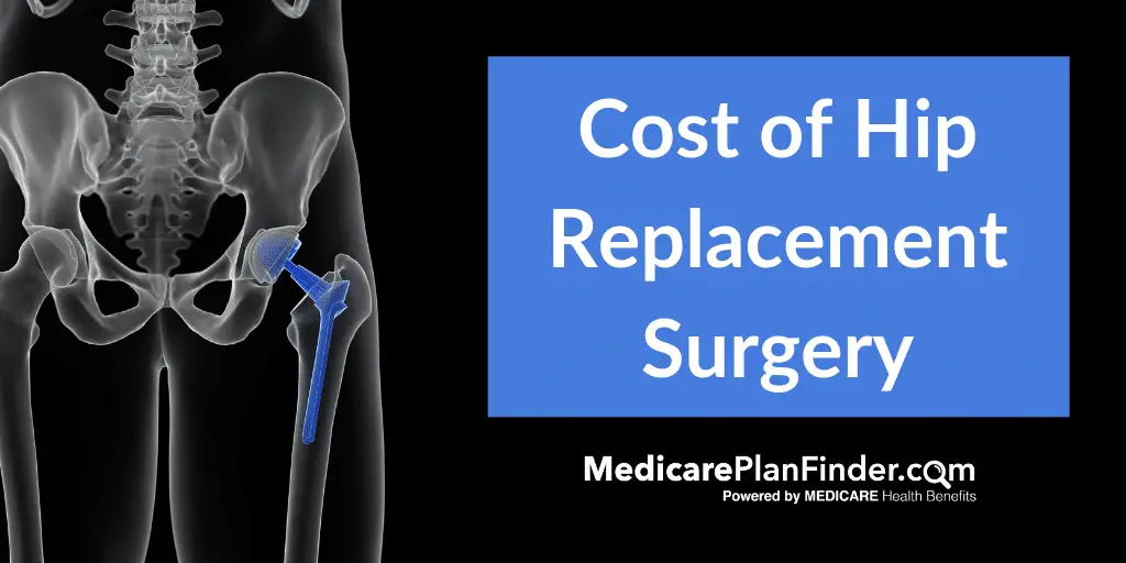 how-much-does-medicare-cover-for-hip-replacement-medicaretalk